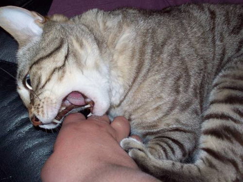 养了4年的猫把主人咬到输液1周